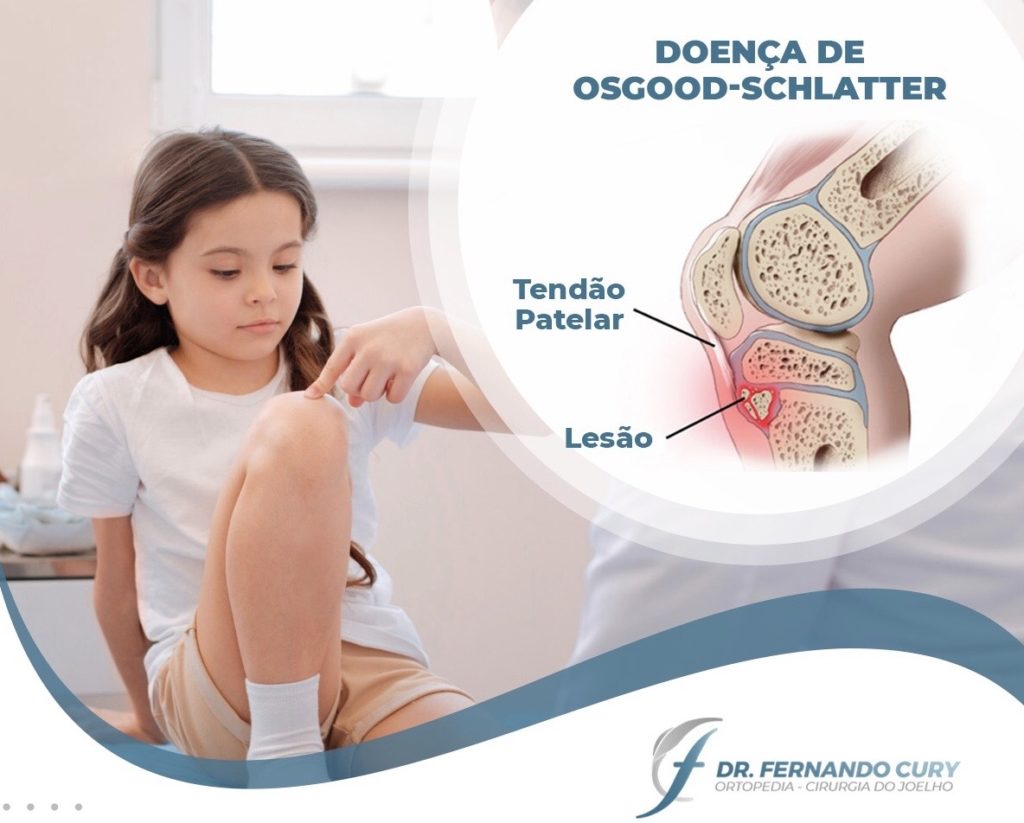 Dor e inchaço na frente do