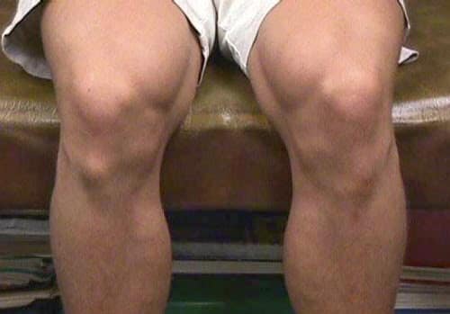 Dor e inchaço na frente do joelho das crianças: o que pode ser? - Dr